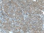 TIP30 Antibody in Immunohistochemistry (Paraffin) (IHC (P))