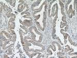 Cdc20 Antibody in Immunohistochemistry (Paraffin) (IHC (P))