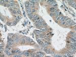 Cdc20 Antibody in Immunohistochemistry (Paraffin) (IHC (P))