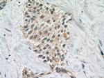 Cdc20 Antibody in Immunohistochemistry (Paraffin) (IHC (P))