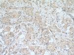 Cdc20 Antibody in Immunohistochemistry (Paraffin) (IHC (P))