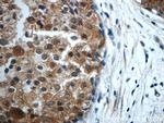 STAT3 Antibody in Immunohistochemistry (Paraffin) (IHC (P))