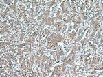 STAT3 Antibody in Immunohistochemistry (Paraffin) (IHC (P))