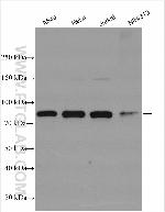 STAT3 Antibody in Western Blot (WB)