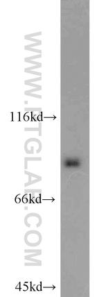 STAT3 Antibody in Western Blot (WB)