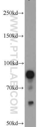 STAT3 Antibody in Western Blot (WB)