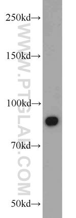 STAT3 Antibody in Western Blot (WB)