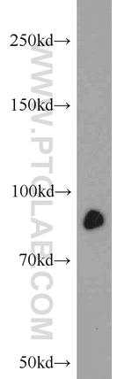 STAT3 Antibody in Western Blot (WB)