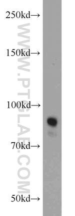 STAT3 Antibody in Western Blot (WB)