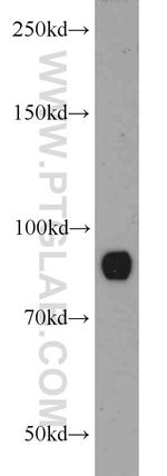 STAT3 Antibody in Western Blot (WB)