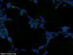 GRB2 Antibody in Immunocytochemistry (ICC/IF)