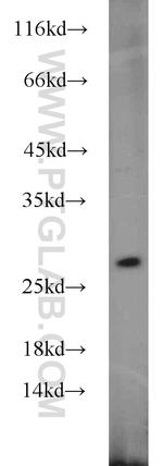 GRB2 Antibody in Western Blot (WB)