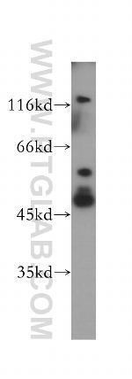 HDAC3 Antibody in Western Blot (WB)