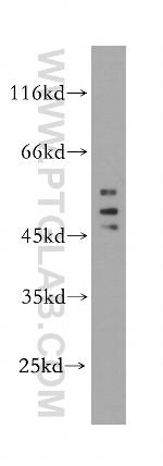 HDAC3 Antibody in Western Blot (WB)