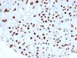 p21WAF1 (Tumor Suppressor Protein) Antibody in Immunohistochemistry (Paraffin) (IHC (P))