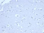 p21WAF1 (Tumor Suppressor Protein) Antibody in Immunohistochemistry (Paraffin) (IHC (P))