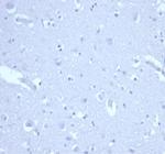 p21WAF1 (Tumor Suppressor Protein) Antibody in Immunohistochemistry (Paraffin) (IHC (P))