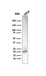 p21WAF1 (Tumor Suppressor Protein) Antibody in Western Blot (WB)