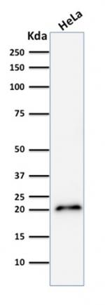 p21WAF1 (Tumor Suppressor Protein) Antibody in Western Blot (WB)