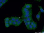 Drebrin Antibody in Immunocytochemistry (ICC/IF)