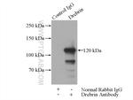 Drebrin Antibody in Immunoprecipitation (IP)