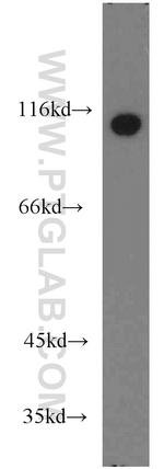 Drebrin Antibody in Western Blot (WB)