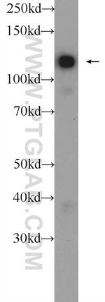 Drebrin Antibody in Western Blot (WB)