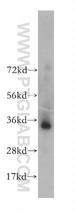 PPP4C Antibody in Western Blot (WB)