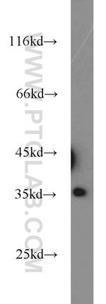 PPP4C Antibody in Western Blot (WB)