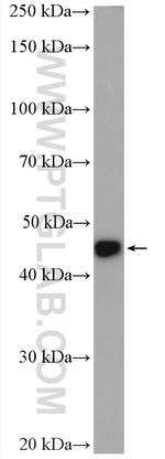 IL11RA Antibody in Western Blot (WB)