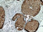 IFNGR2 Antibody in Immunohistochemistry (Paraffin) (IHC (P))