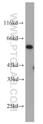 IFNGR2 Antibody in Western Blot (WB)