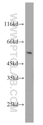 IFNGR2 Antibody in Western Blot (WB)