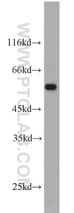 IFNGR2 Antibody in Western Blot (WB)