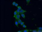 IkB alpha Antibody in Immunocytochemistry (ICC/IF)