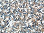 IkB alpha Antibody in Immunohistochemistry (Paraffin) (IHC (P))