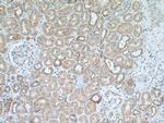 IkB alpha Antibody in Immunohistochemistry (Paraffin) (IHC (P))