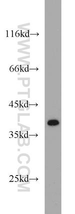 IkB alpha Antibody in Western Blot (WB)