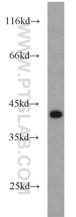 IkB alpha Antibody in Western Blot (WB)