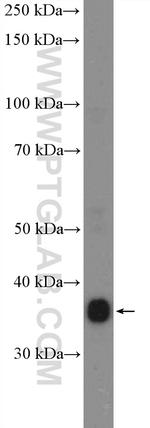 IkB alpha Antibody in Western Blot (WB)