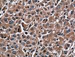 SOD1 Antibody in Immunohistochemistry (Paraffin) (IHC (P))