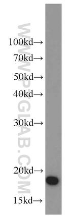 SOD1 Antibody in Western Blot (WB)