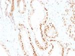 p27Kip1 (Mitotic Inhibitor/Suppressor Protein) Antibody in Immunohistochemistry (Paraffin) (IHC (P))