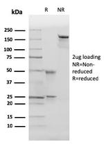 p27Kip1 (Mitotic Inhibitor/Suppressor Protein) Antibody in SDS-PAGE (SDS-PAGE)