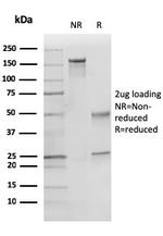 p27Kip1 (Mitotic Inhibitor/Suppressor Protein) Antibody in SDS-PAGE (SDS-PAGE)