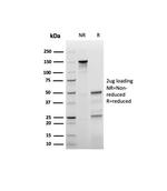 p27Kip1 (Mitotic Inhibitor/Suppressor Protein) Antibody in SDS-PAGE (SDS-PAGE)