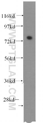 FAF1 Antibody in Western Blot (WB)