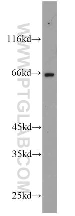 FAF1 Antibody in Western Blot (WB)