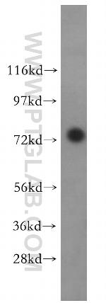 FAF1 Antibody in Western Blot (WB)