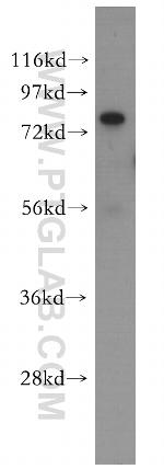 FAF1 Antibody in Western Blot (WB)